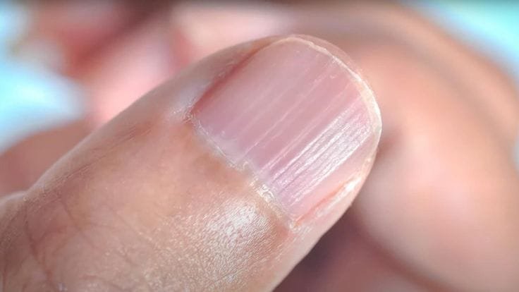 nailslines - NewsOk