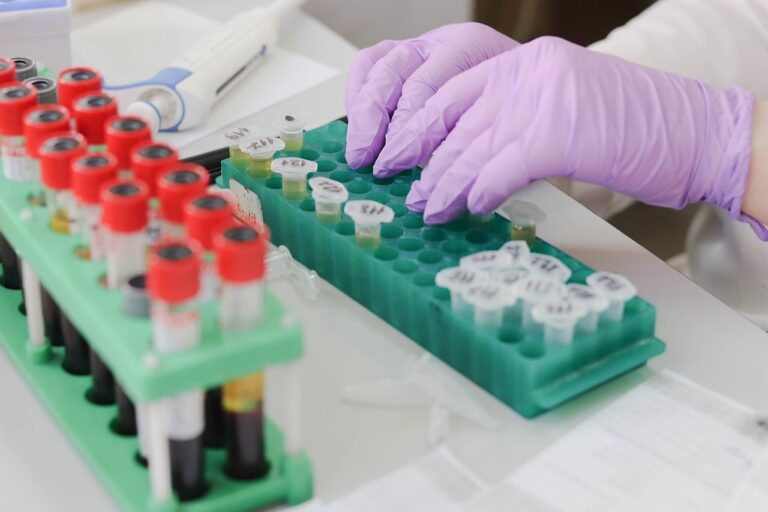 bloodtests_oixabay - NewsOk