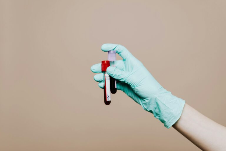 blood_pexels - NewsOk