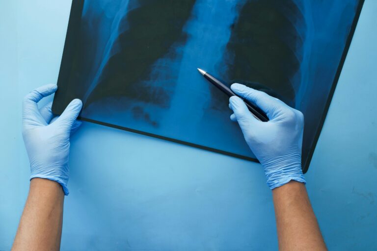 lung_pexels - NewsOk