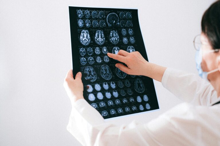 pexels-brain - NewsOk